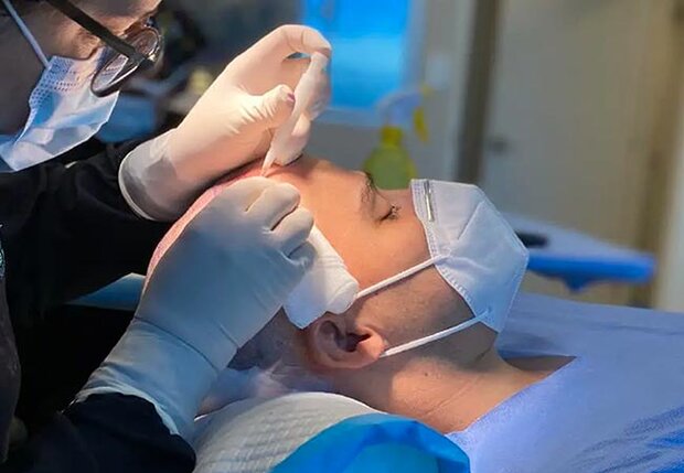 کاشت مو به روش FIT و FUT؛ بررسی مزایا، معایب و هزینه‌ها